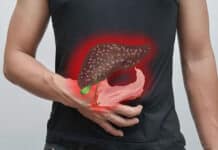 Quels aliments nuisent au foie ?